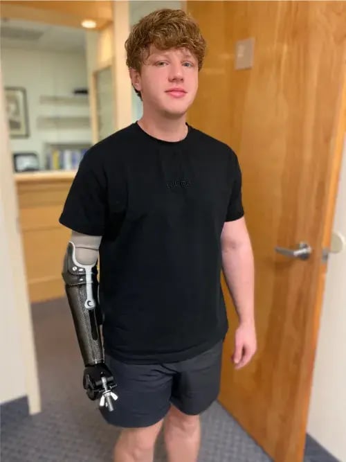 weightlifter with prosthetic arm